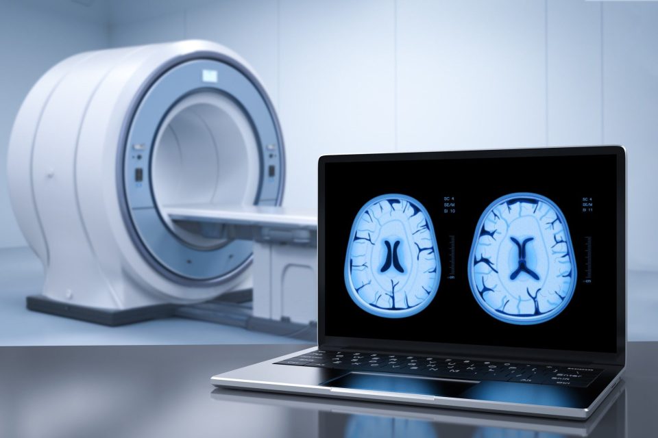 Functional Magnetic Resonance Imaging (fMRI)